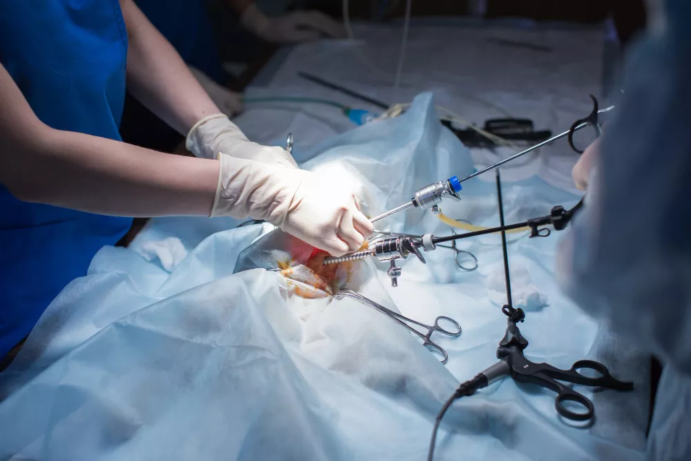 Laparoscopic Surgeries